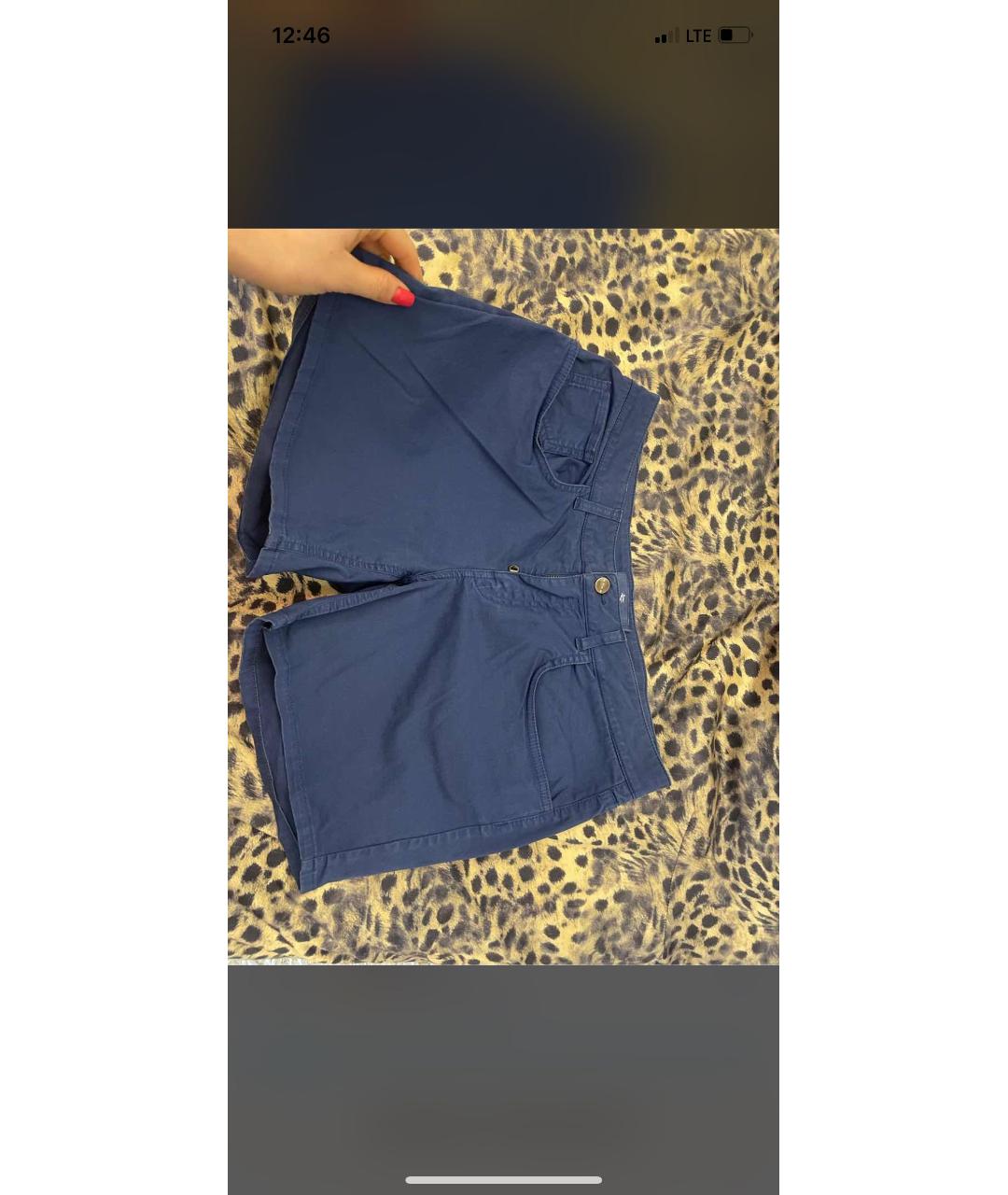 ETRO Синие хлопко-эластановые шорты, фото 5