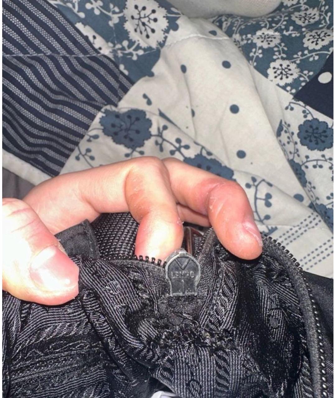 thumb