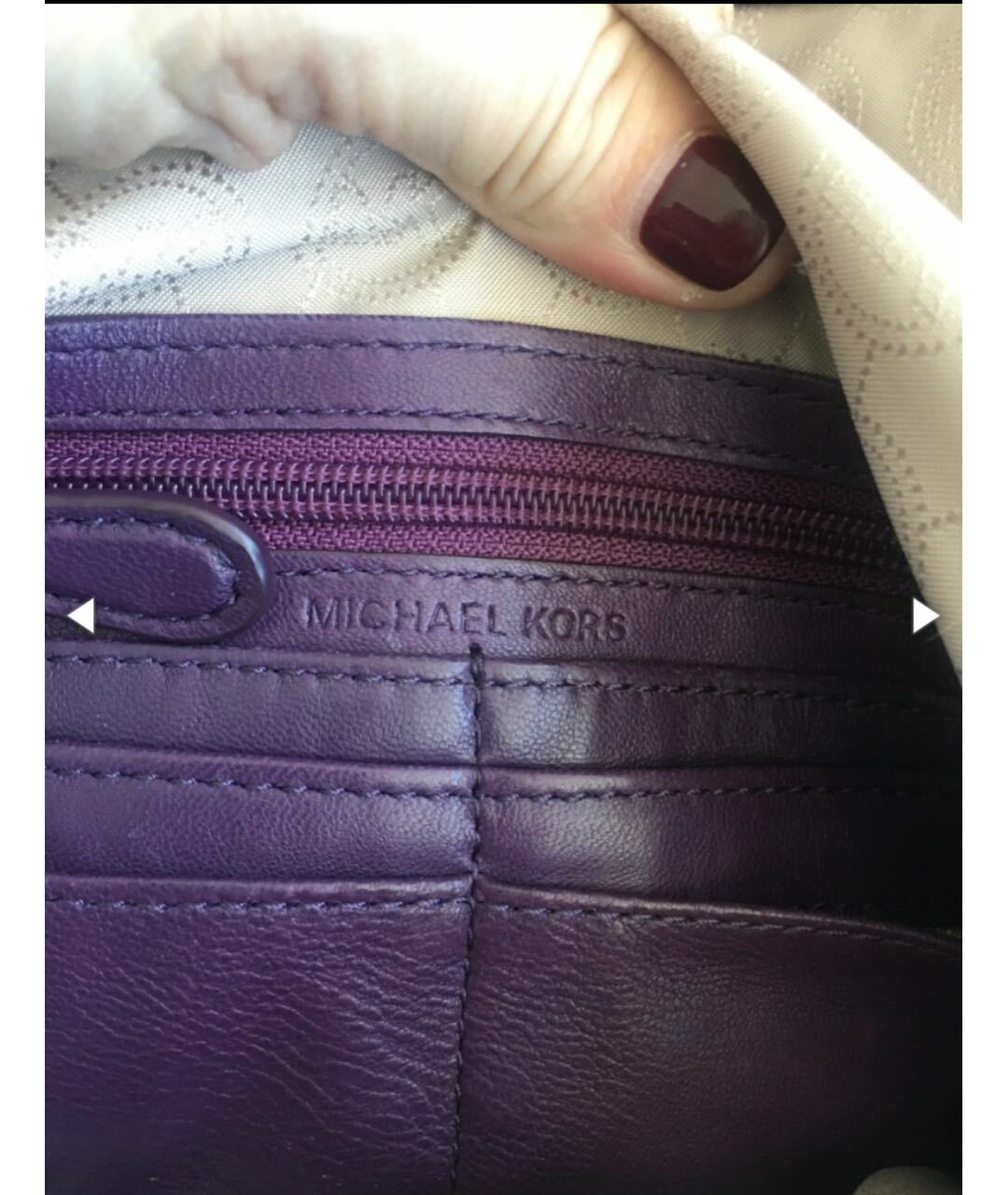 thumb
