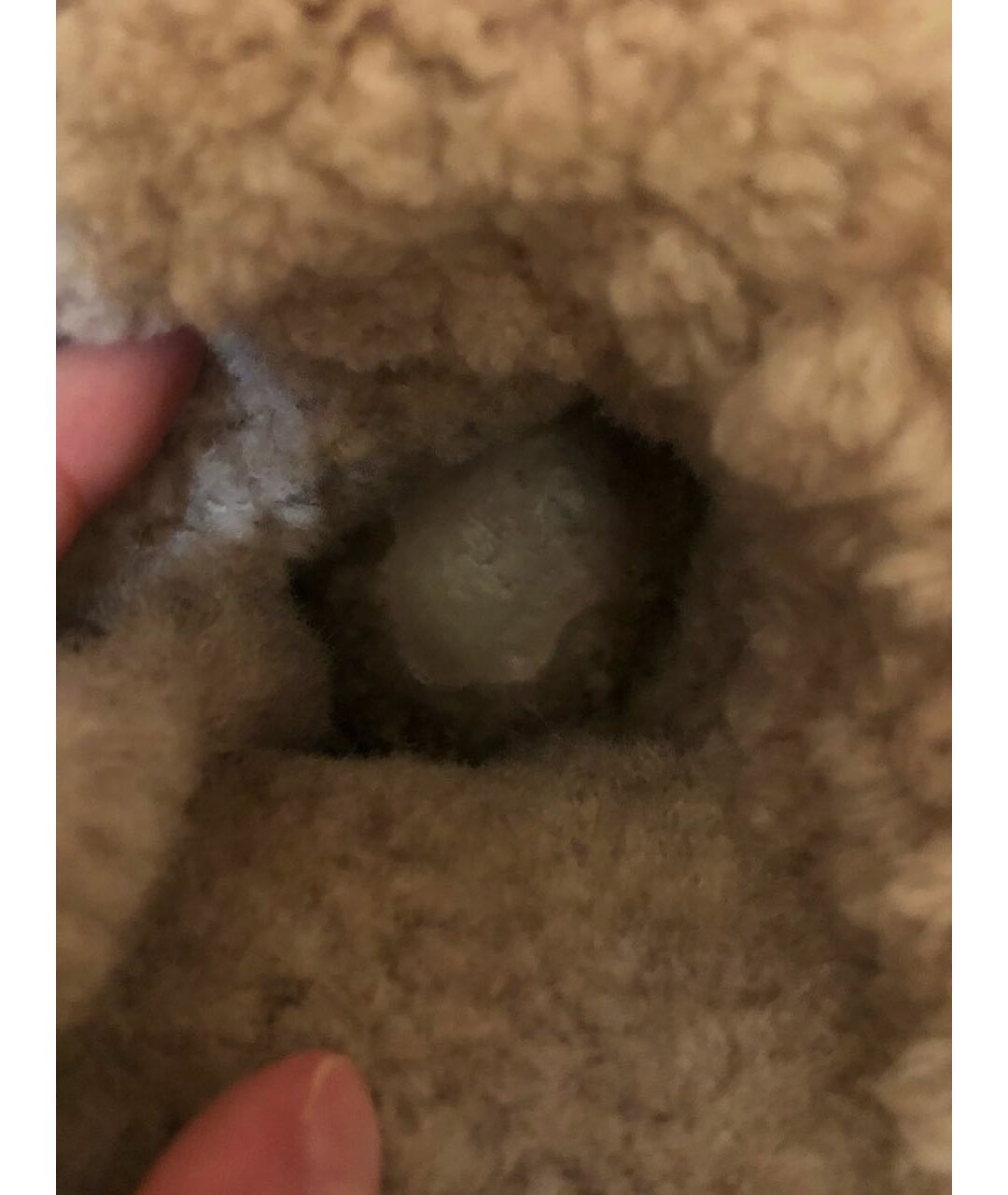 thumb
