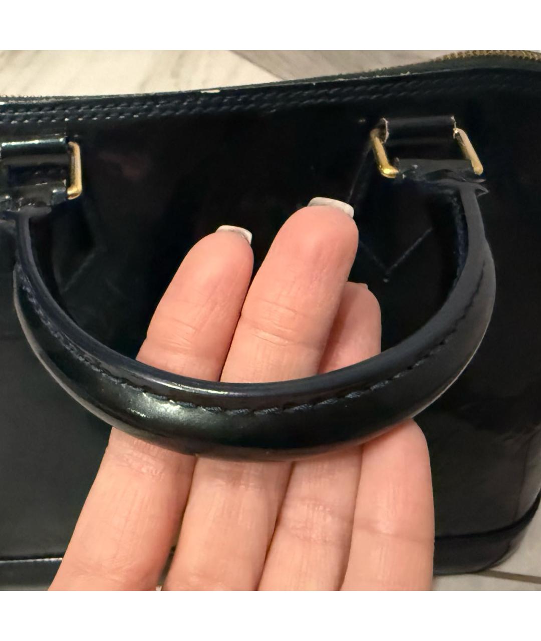 LOUIS VUITTON Бирюзовая сумка с короткими ручками из лакированной кожи, фото 8