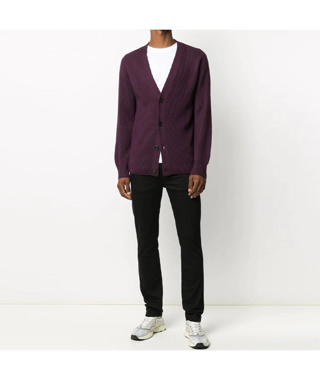 ACNE STUDIOS Черные хлопковые джинсы скинни, фото 2