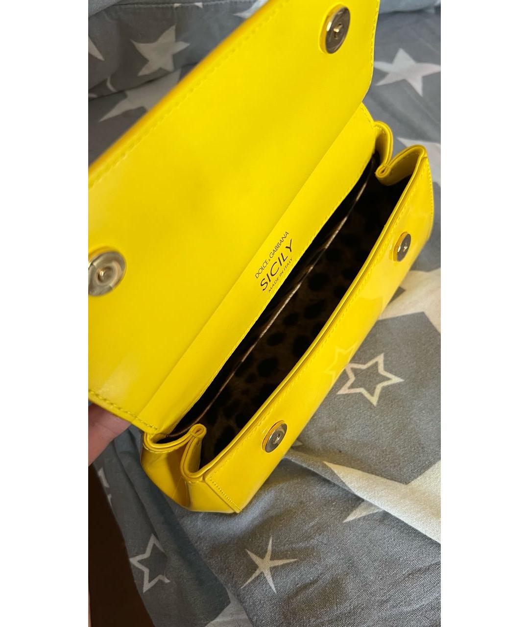 DOLCE&GABBANA Желтая сумка с короткими ручками из лакированной кожи, фото 4
