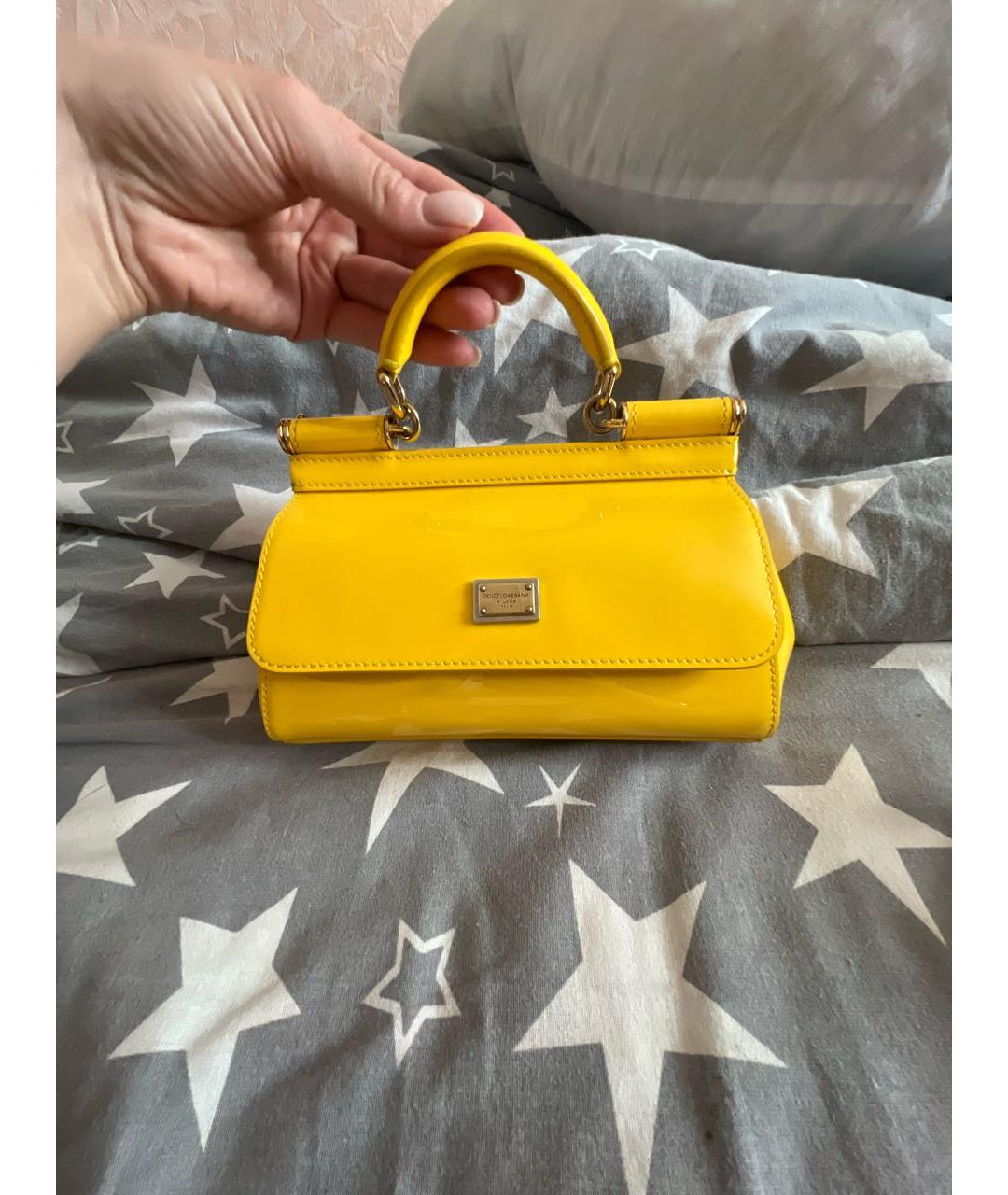 DOLCE&GABBANA Желтая сумка с короткими ручками из лакированной кожи, фото 9