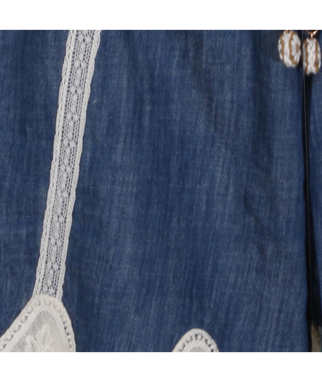 ZIMMERMANN Синие хлопковые шорты, фото 4