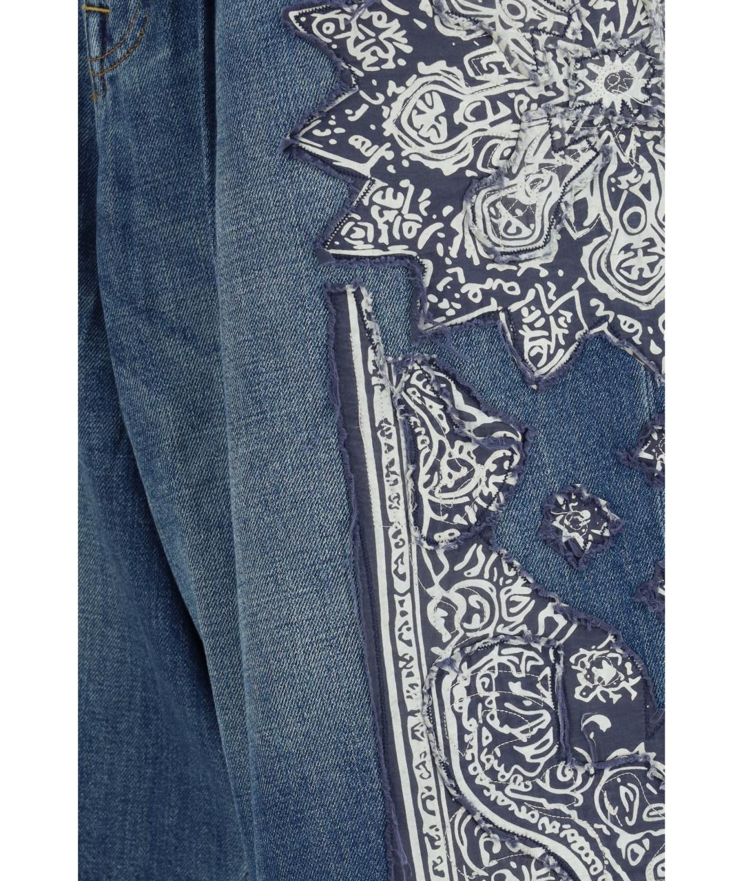 R13 Синие хлопковые шорты, фото 3