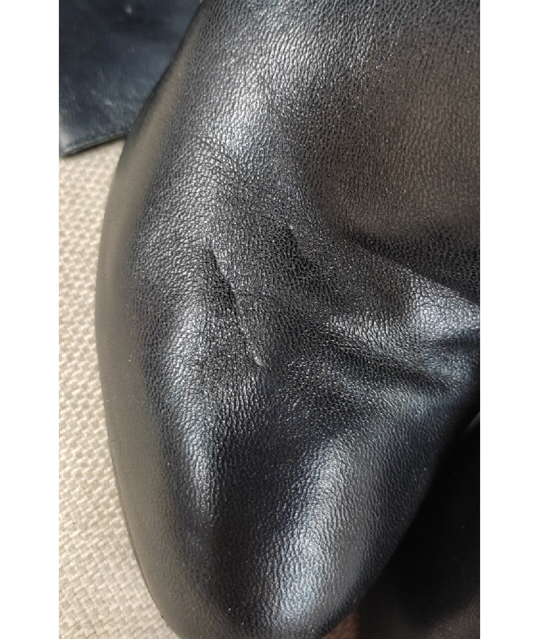 thumb