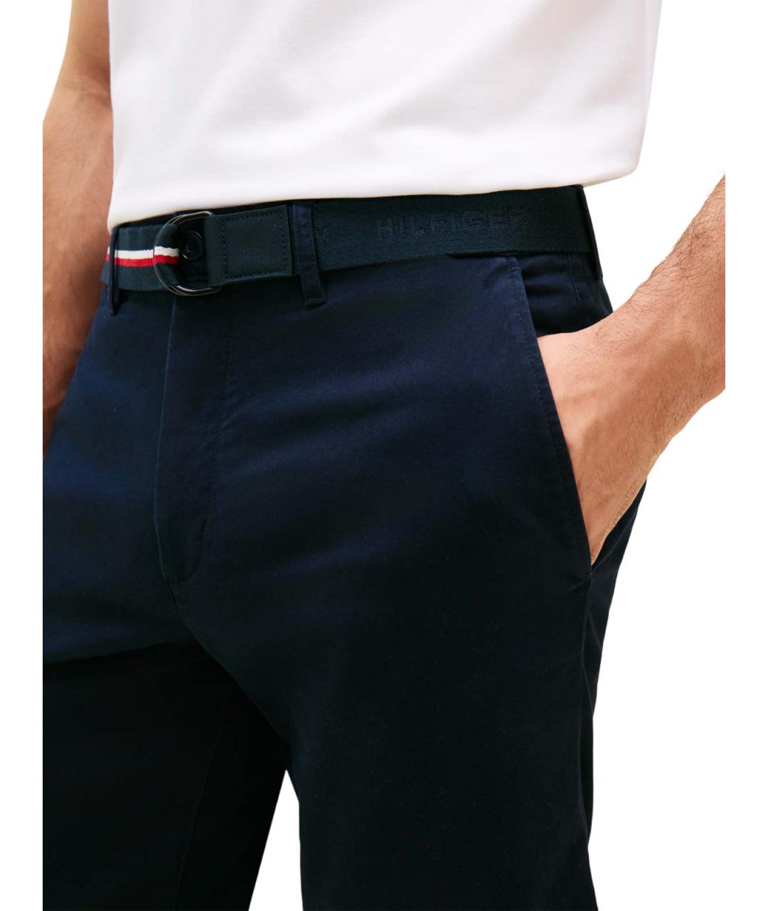 TOMMY HILFIGER Синие хлопковые шорты, фото 3