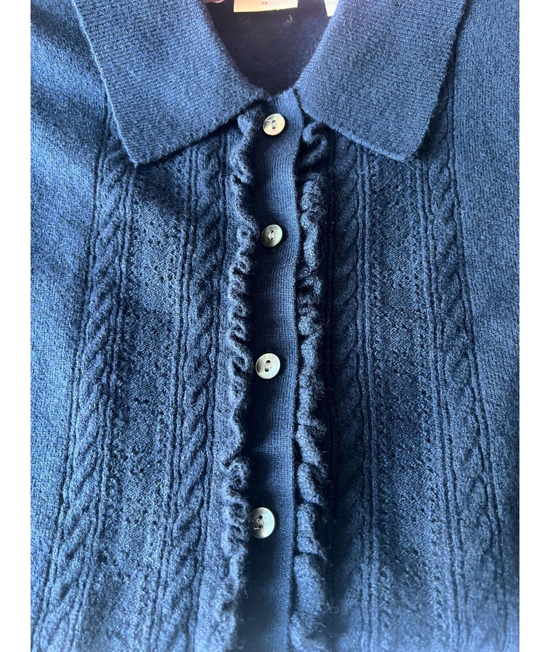 LEVI'S Темно-синяя хлопко-эластановая жилетка, фото 4